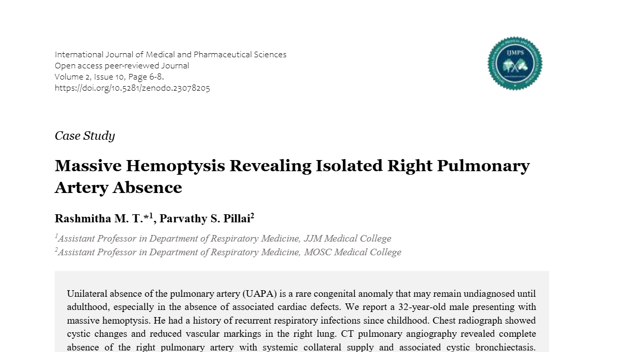 Massive Hemoptysis Revealing Isolated Right Pulmonary Artery Absence